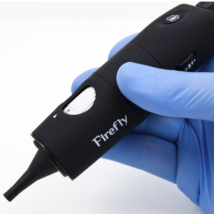 Firefly DE500 Video Otoscope